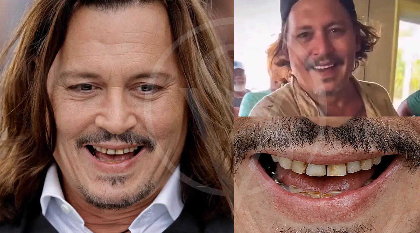 How Johnny Depp's Teeth Went from Iconic to Infamous—And Why Dentists ...